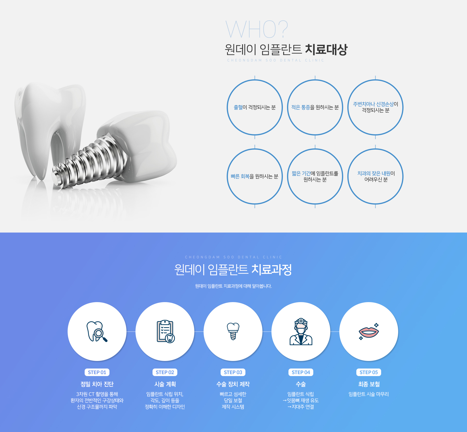 청담수치과 원데이임플란트