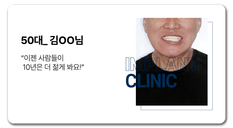 실제 임플란트 환자의 리얼후기 10