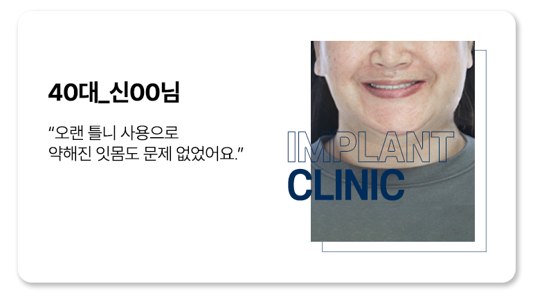 실제 임플란트 환자의 리얼후기 13