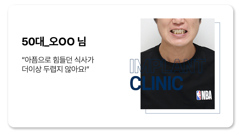 실제 임플란트 환자의 리얼후기 8